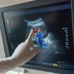 Internistische Expertise: Bernhard Scheja zu innovativen Anwendungen der Organsonografie