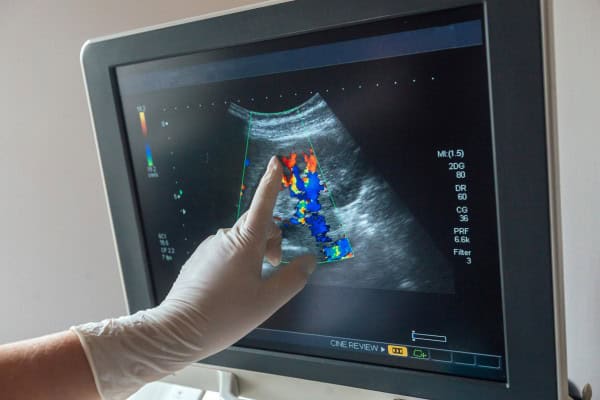 Internistische Expertise: Bernhard Scheja zu innovativen Anwendungen der Organsonografie